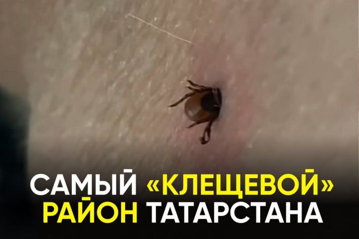 Названы районы Татарстана с наибольшим числом обращений из-за укусов клещей